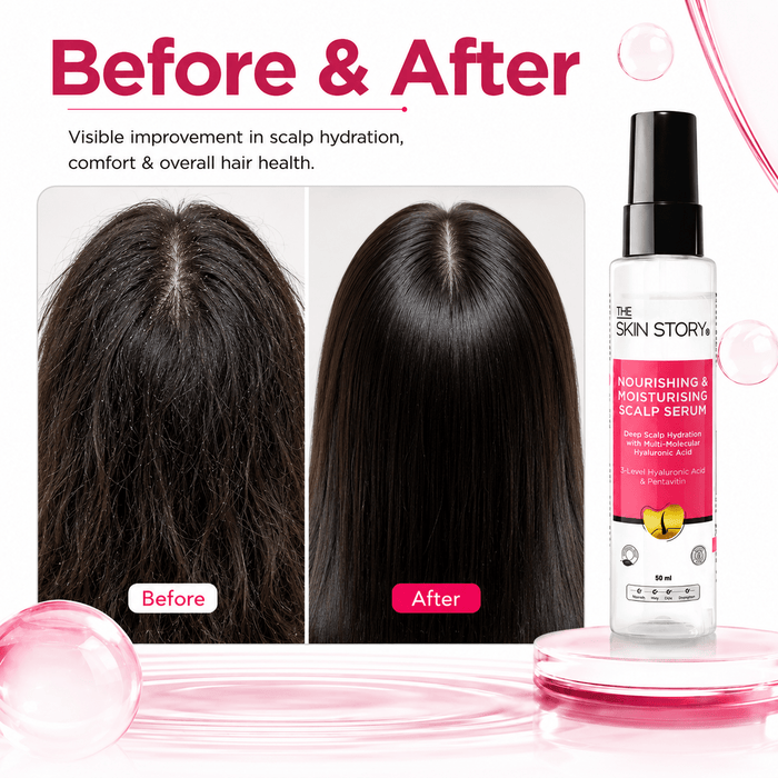 The Skin Story Nourishing and Moisturising Scalp Serum, 50ml - The Skin Story - Hair Serum